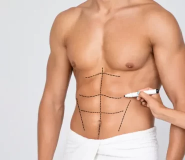 Six pack ameliyatı kalıcı mıdır?